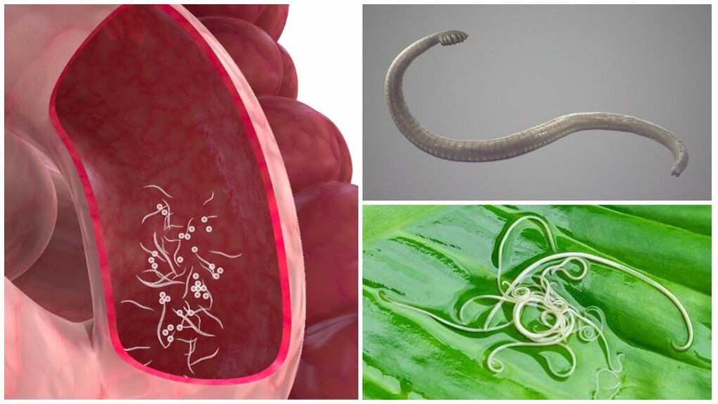 Parasites dans le corps humain