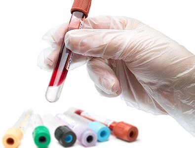 Test sanguin pour les parasites