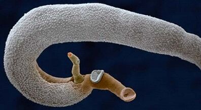 Quels parasites peuvent vivre dans un estomac humain