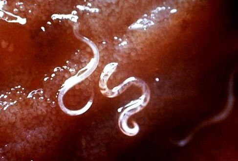 parasites à l'intérieur du corps