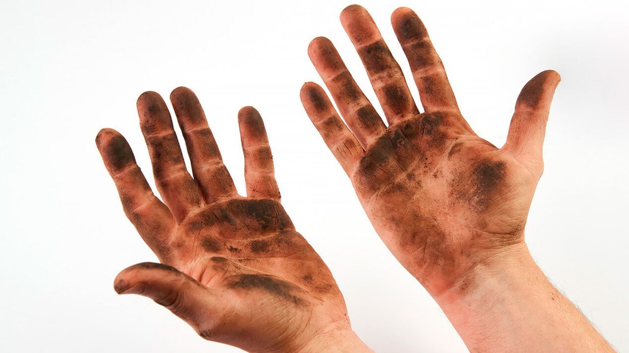 Ceux qui abusent des règles d'hygiène et ne se lavent pas les mains risquent de contracter des vers.
