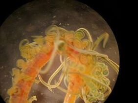 les vers sont des parasites du corps humain