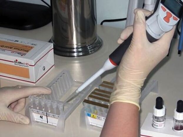 Tests de laboratoire pour diagnostiquer les maladies parasitaires
